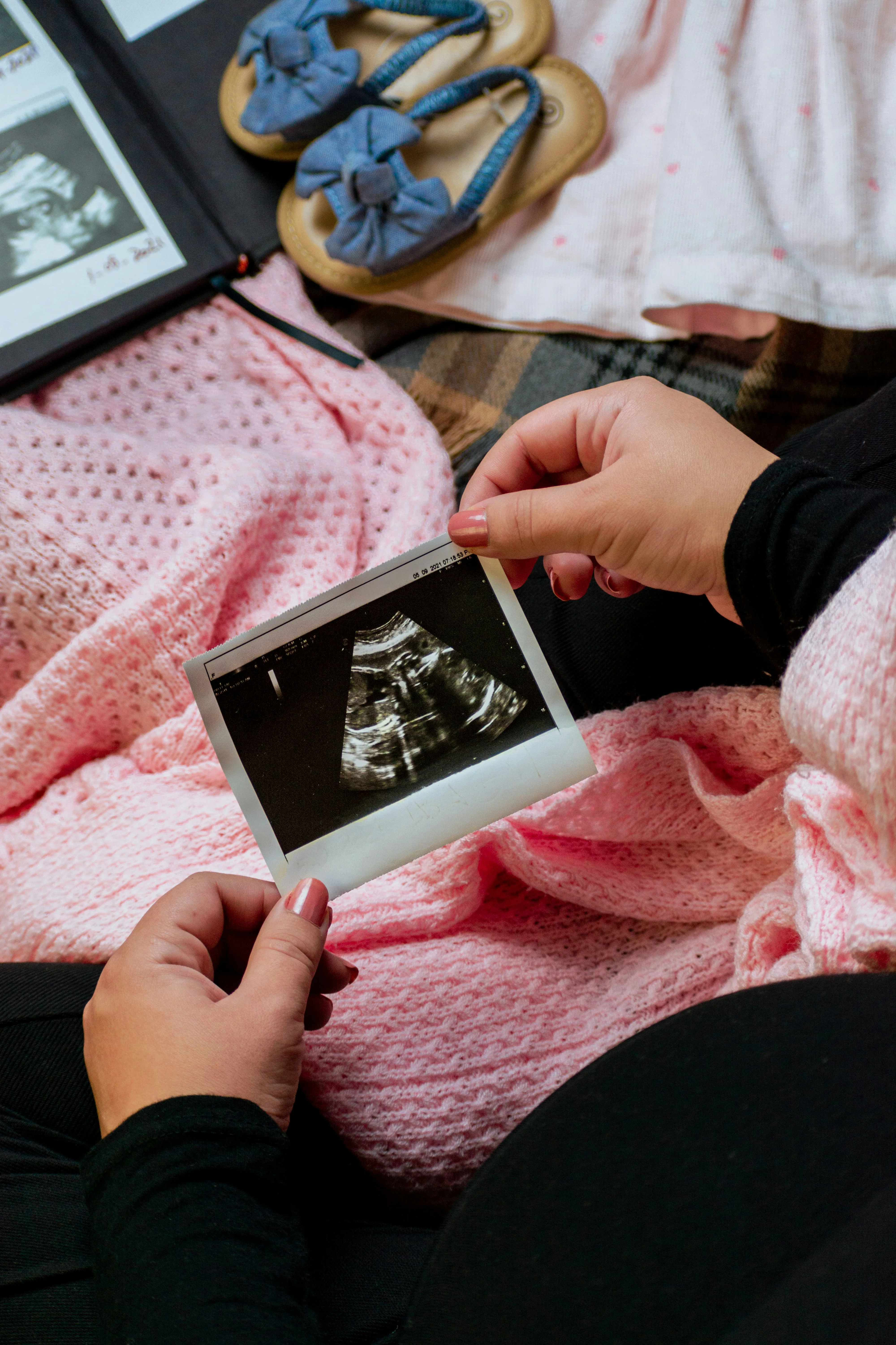 person holding picture of a ultrasound image